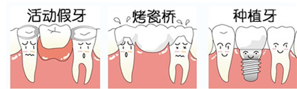 什么是种植牙齿?种植牙齿的好处和危害都有哪些?