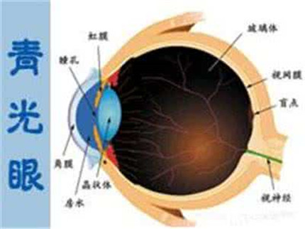 青光眼的症状有哪些?青光眼可以治得好吗?