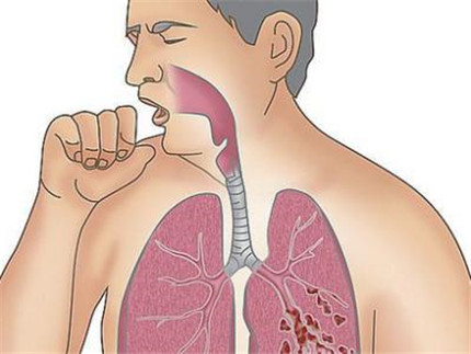 老年人肺气肿有哪些危害?老年人肺气肿可以治得好吗?