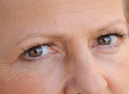 老年人青光眼的成因是什么?老年人青光眼的三大注意事项