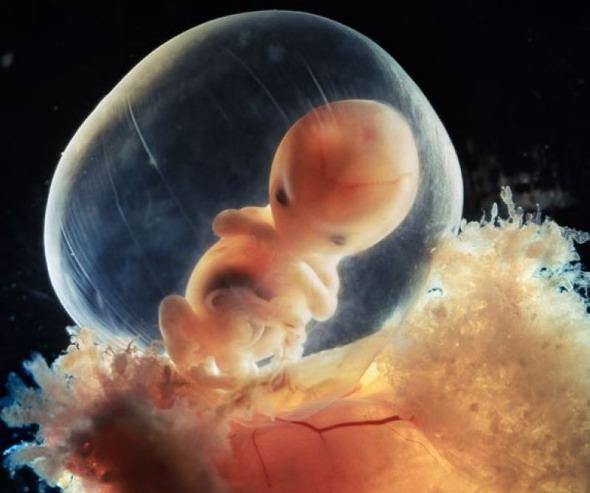 胎儿在羊水里是如何呼吸与运动的?羊水的功能主要有哪些?