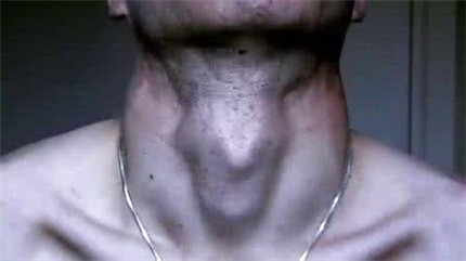 喉结的作用介绍 男人没有喉结是为什么?