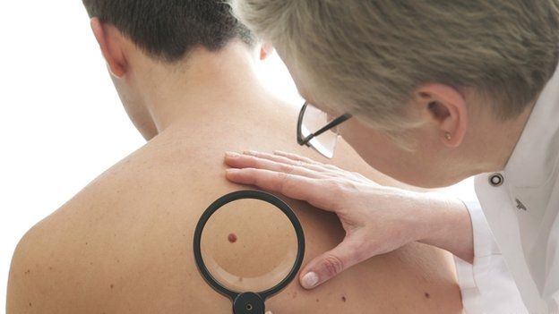 皮肤癌的早期症状有哪些?皮肤癌可以治好吗?