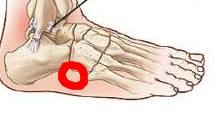 脚踝疼的原因有哪些?推荐一些缓解脚踝疼的动作