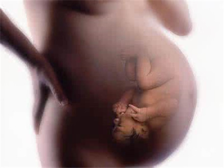 胎粪吸入综合征是怎么引起的?胎粪吸入综合征怎么办?