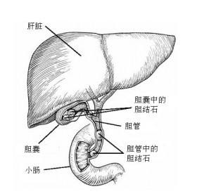 胆囊炎的病因有哪些?预防胆囊炎的六大方法