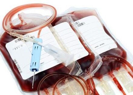 告诉你直系亲属为什么不能献血 死亡率极高