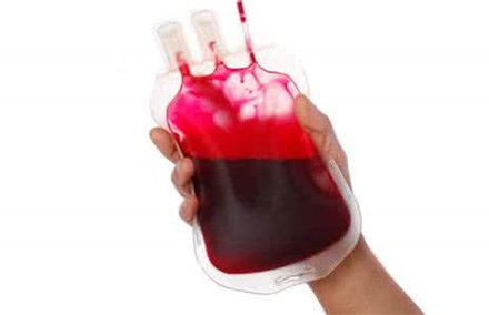 告诉你直系亲属为什么不能献血 死亡率极高