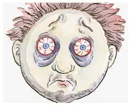 红眼病的传播途径有哪些?如何有效的预防红眼病?