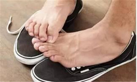 香港脚的症状大全介绍 香港脚为什么要叫香港脚?