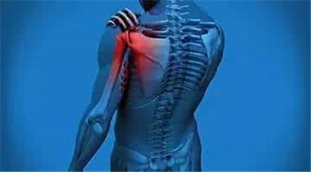 20个治疗肩周炎的偏方 彻底告别肩周炎