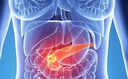 胰腺癌的早期症状 中医治疗胰腺癌3大偏方