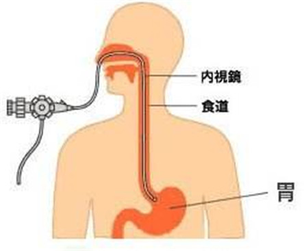 胃镜检查前后注意事项 胃镜检查费用多少?