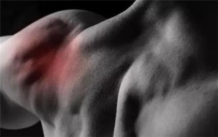 运动后肌肉酸痛的原因 运动后肌肉酸痛怎么办?