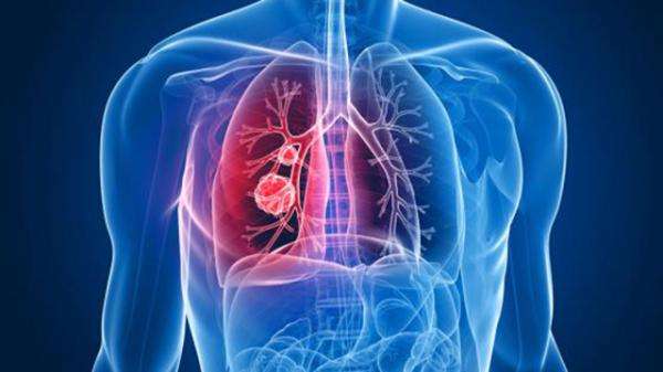 肺炎导致呼吸衰竭 如何预防肺炎?