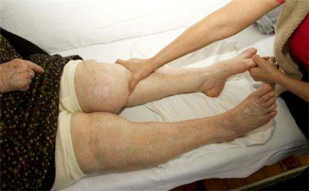 老人夜间腿抽筋怎么办?预防老人夜间腿抽筋?