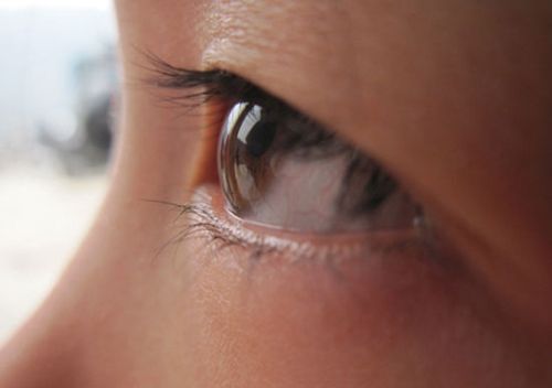 干眼症的原因及症状 经常点人工泪液有副作用吗?