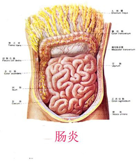 放射性直肠炎 小心有癌变的可能