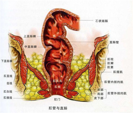 放射性直肠炎 小心有癌变的可能