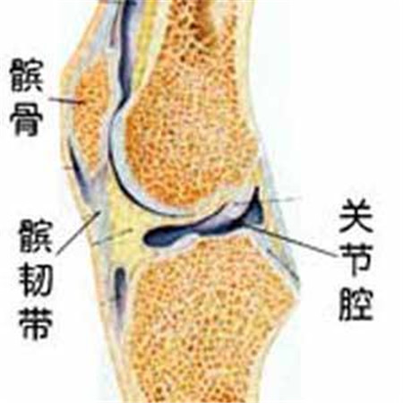 膝盖响可不是缺钙 而是一种髌骨软骨软化症