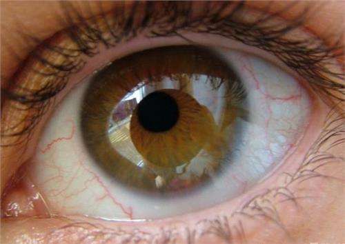 干眼症会引发忧郁焦虑 小心5种会诱发干眼症药物