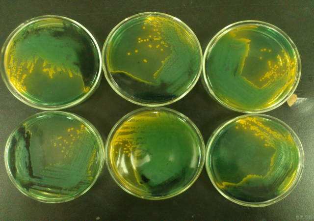 海洋弧菌感染恐致命 预防胜于治疗谨记3锦囊