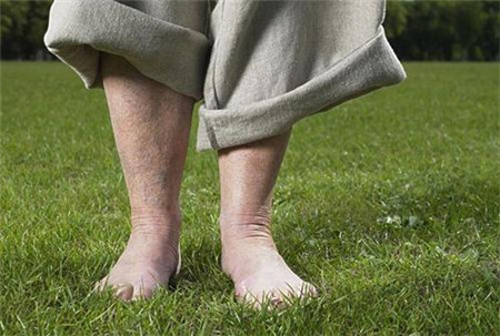 老人经常脚抽筋怎么办?这些食物可以帮你提前预防