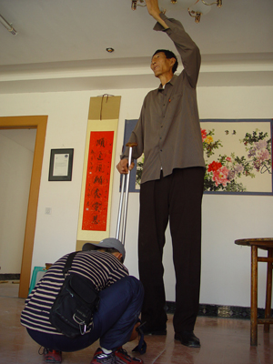 世界第一高人詹世钗 身高3.19米到底是为什么