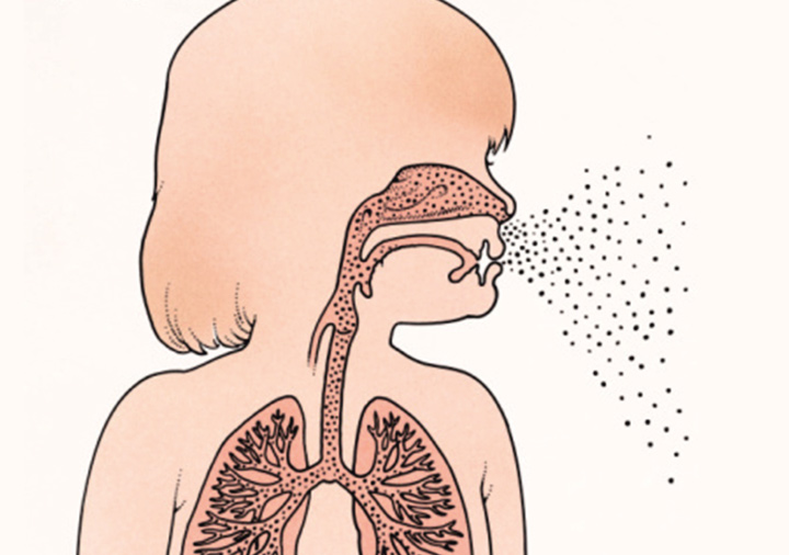  慢性咽炎的病因有哪些？